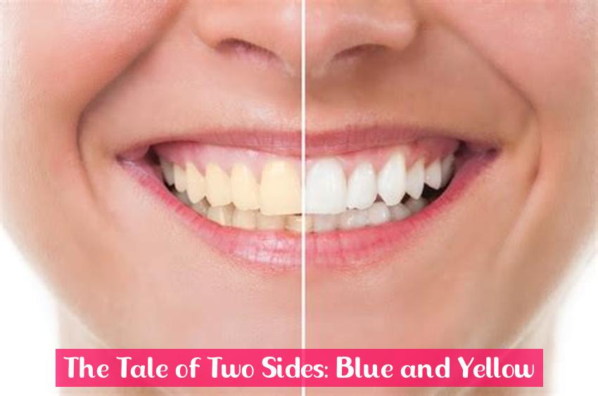 The Tale of Two Sides: Blue and Yellow